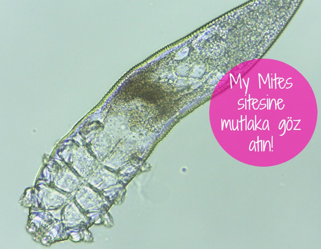 mites